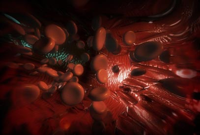 Hypertension Microscopic Animation